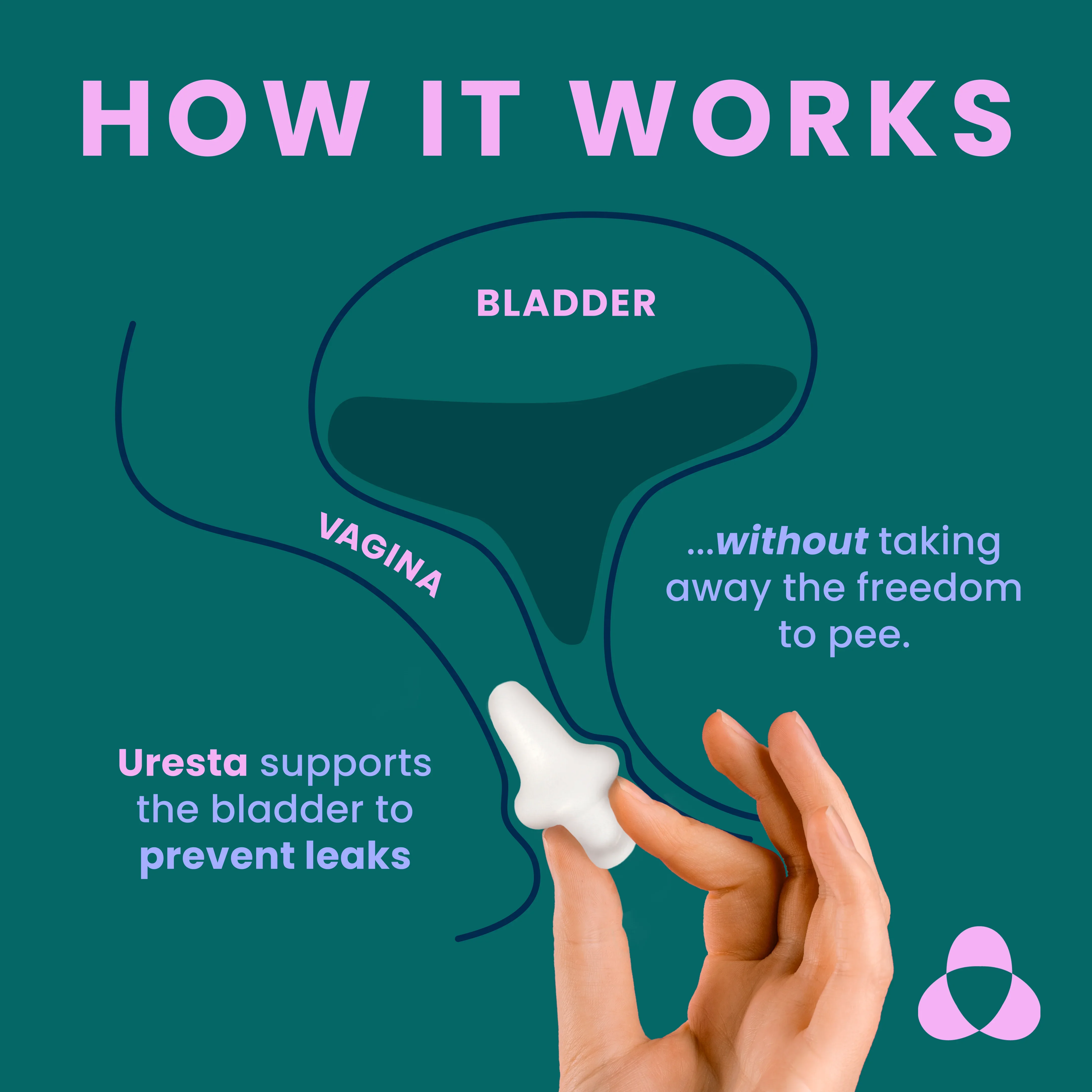 Bladder Support Starter Kit - Image 3